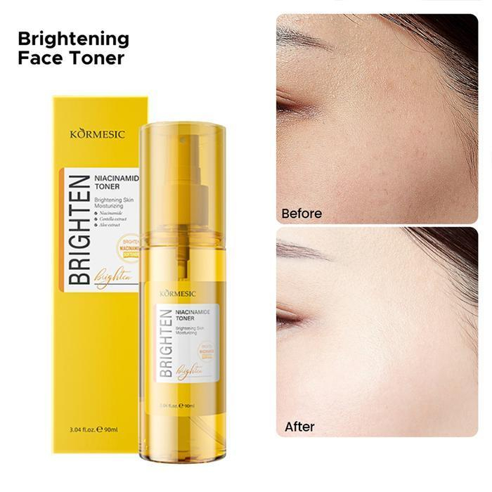 kormesic niacinamide toner 90ml/toner wajah kormesic niacinamide toner 90ml/toner wajah