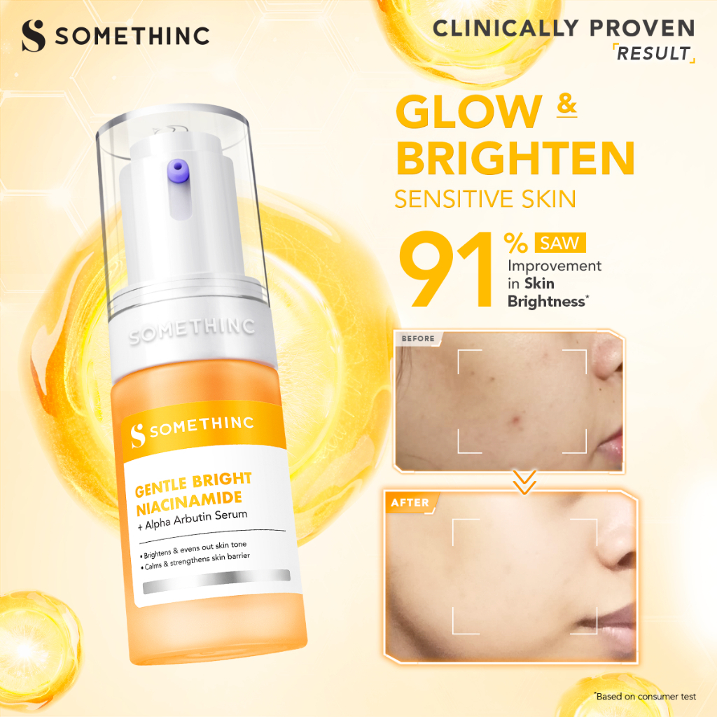 somethinc gentle bright niacinamide alpha arbutin serum 20ml/serum wajah somethinc gentle bright niacinamide alpha arbutin serum 20ml/serum wajah