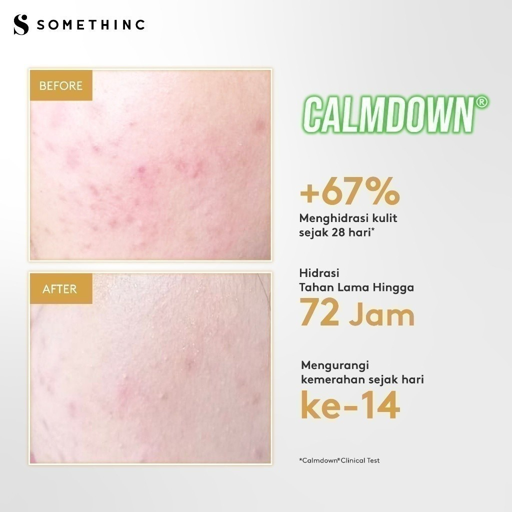 somethinc calm down skinpair r cover cream moisturizer/pelembab wajah somethinc calm down skinpair r cover cream moisturizer/pelembab wajah