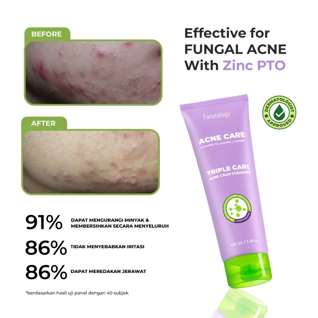 facetology triple care acne calm cleanser 100ml/pembersih wajah facetology triple care acne calm cleanser 100ml/pembersih wajah