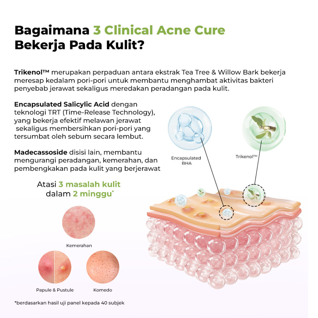 facetology triple care acne calm moisturizer 35g/pelembab wajah facetology triple care acne calm moisturizer 35g/pelembab wajah