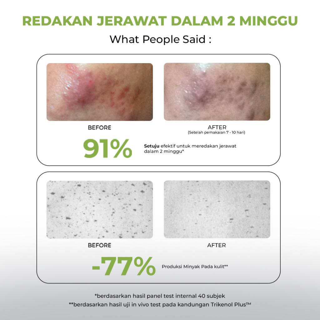 facetology triple care acne calm moisturizer 35g/pelembab wajah facetology triple care acne calm moisturizer 35g/pelembab wajah