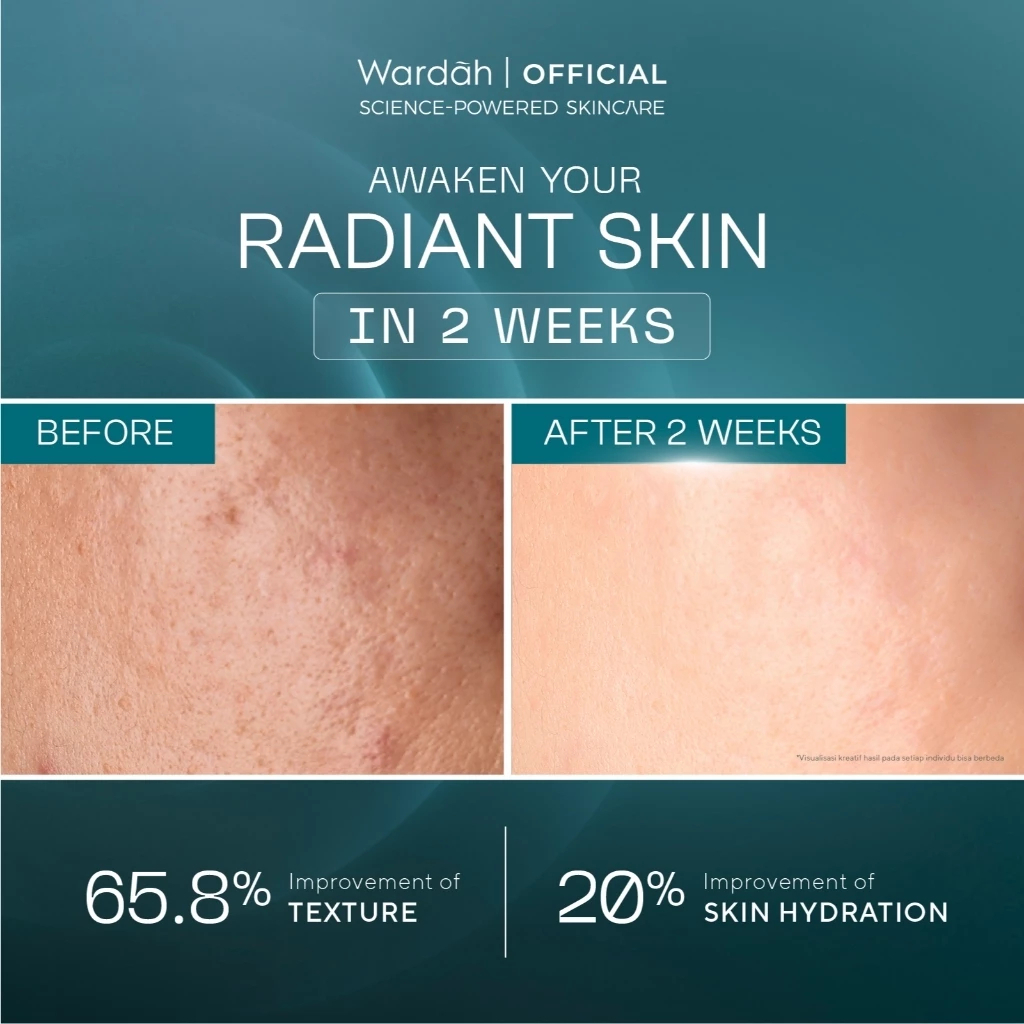 wardah retinal liposome cysteamine radiant resurfacing serum 30ml/serum wajah wardah retinal liposome cysteamine radiant resurfacing serum 30ml/serum wajah