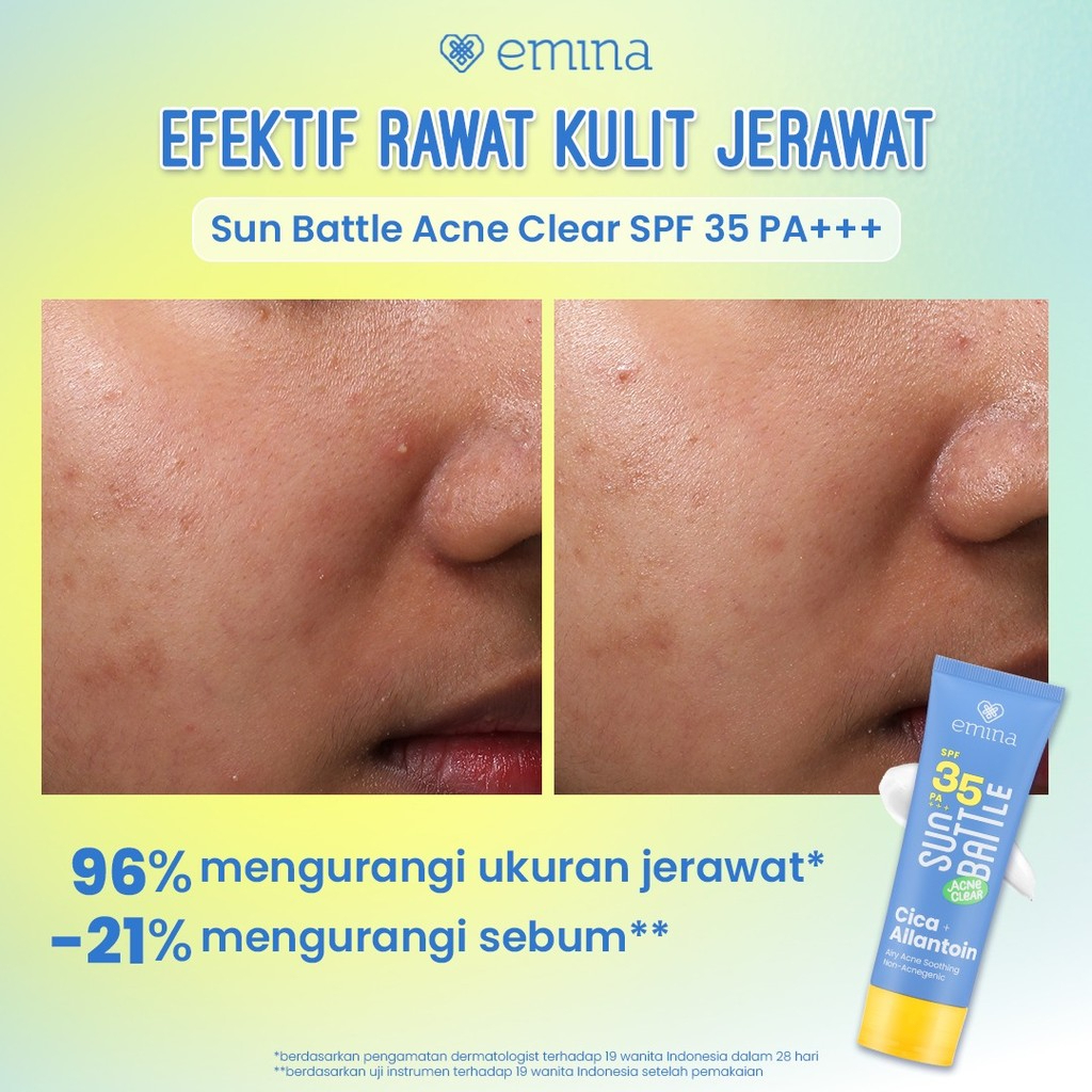 emina sun battle acne clear cica allantoin airy acne soothing sunscreen spf 35 pa+++ 50ml/tabir surya emina sun battle acne clear cica allantoin airy acne soothing sunscreen spf 35 pa+++ 50ml/tabir surya