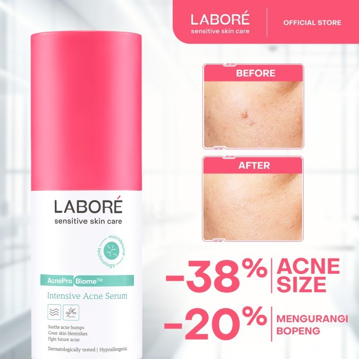 labore sensitive skin care acne serum 7ml and 20ml/perawatan wajah labore sensitive skin care acne serum 7ml and 20ml/perawatan wajah