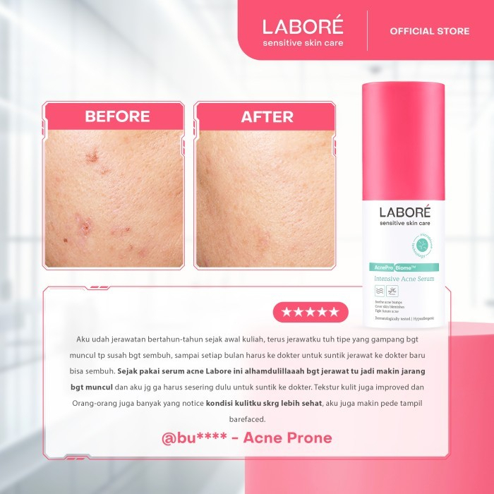 labore sensitive skin care acne serum 7ml and 20ml/perawatan wajah labore sensitive skin care acne serum 7ml and 20ml/perawatan wajah