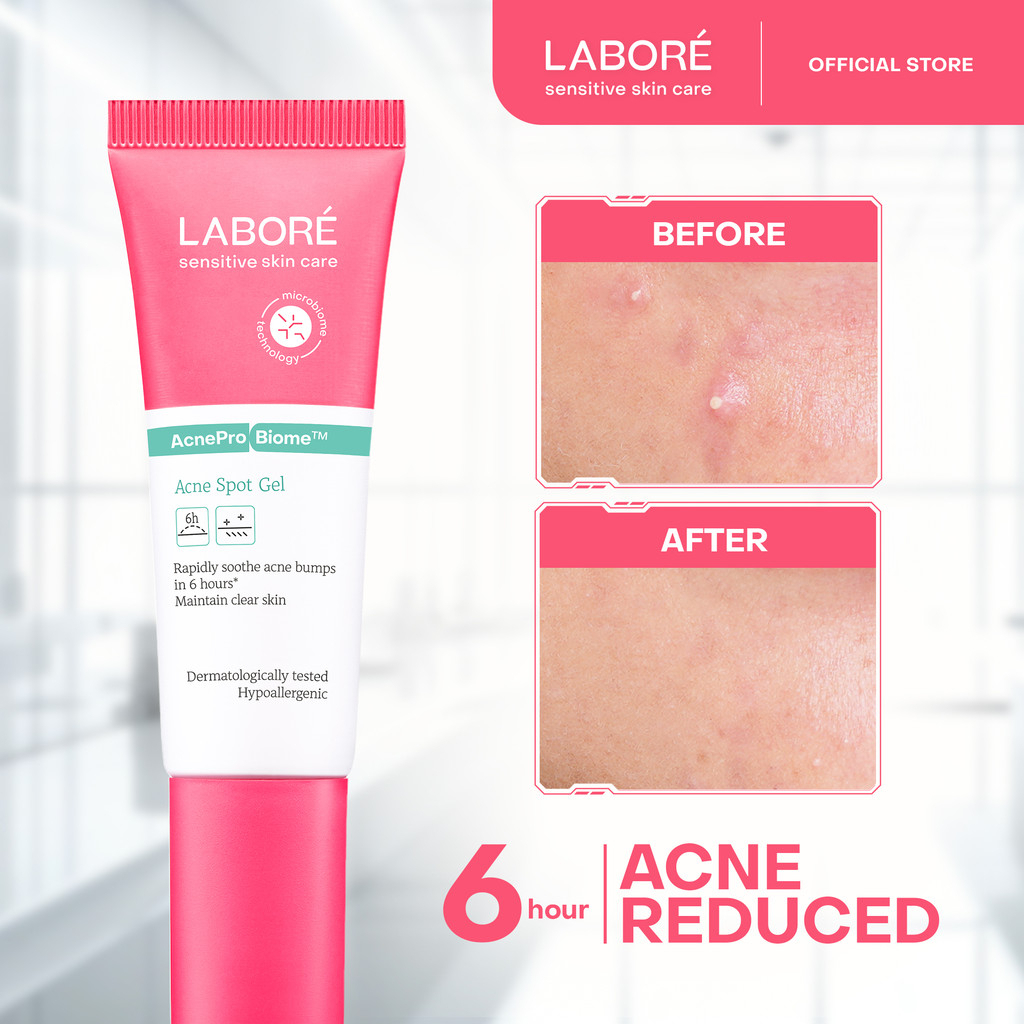 labore acne pro biome acne spot gel 15ml/obat totol jerawat labore acne pro biome acne spot gel 15ml/obat totol jerawat