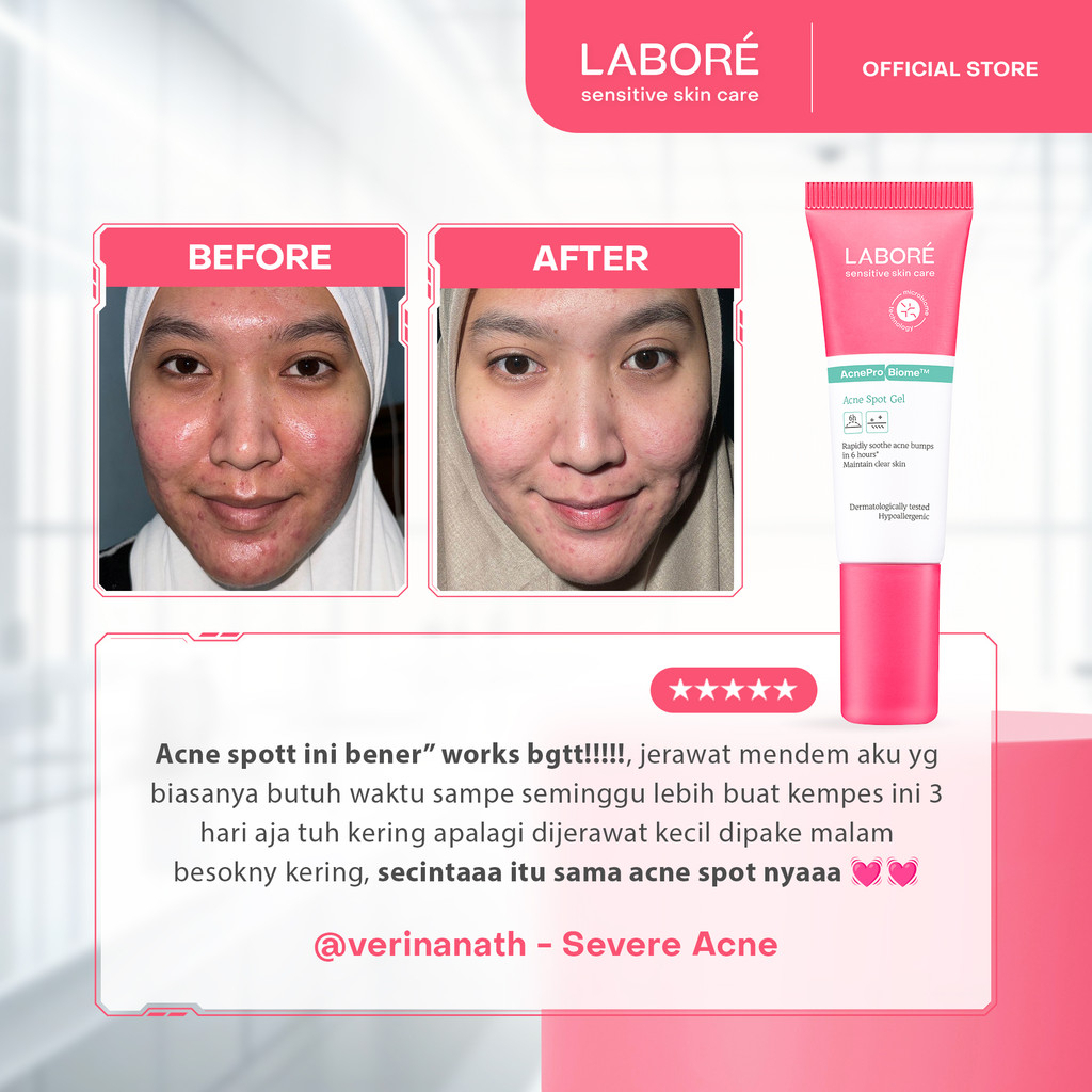 labore acne pro biome acne spot gel 15ml/obat totol jerawat labore acne pro biome acne spot gel 15ml/obat totol jerawat
